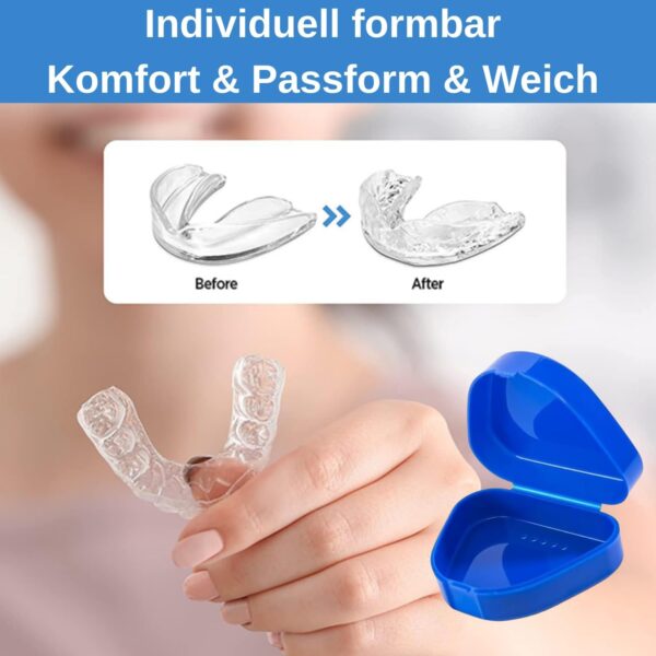 Night Grinding Splint, Teeth Splint, Grinding, Pack of 4, Bite Splint for the Night, Snoring Splint, Teeth Splint, Prevent Bruxism