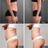 Slimming Patch, Pack of 50 Slim Patch Fat Burner Plasters, Natural Weight Loss Plasters for Fast Weight Loss, Appetite Control & Metabolism Boost, Effective Fat Burning
