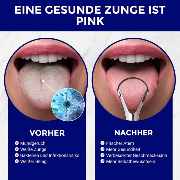 71QiHkBQoES._AC_SL1500_.jpg Tongue Scraper Stainless Steel Tongue Cleaner Set Tongue Cleaner Stainless Steel Tongue Brush Stainless Steel Tongue Scraper Tongue Cleaner Stainless Steel ORAVIX